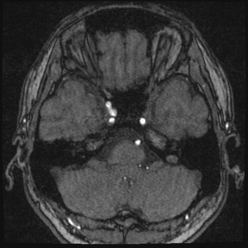 Click on the Serie image to view the images of VILLANUEVA, WILLIAM A.